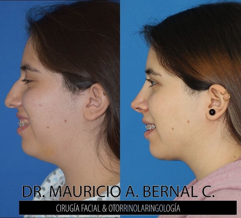 Mauricio Alejandro Bernal Carreon-30