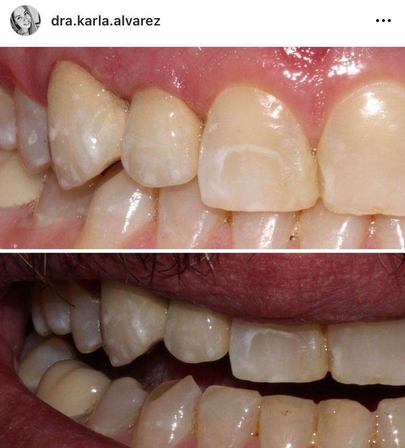 Karla Alvarez Treviño-19