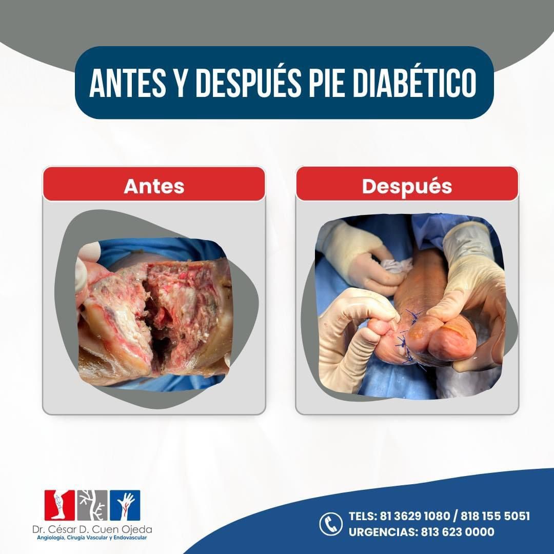 César Daniel Cuen Ojeda-18