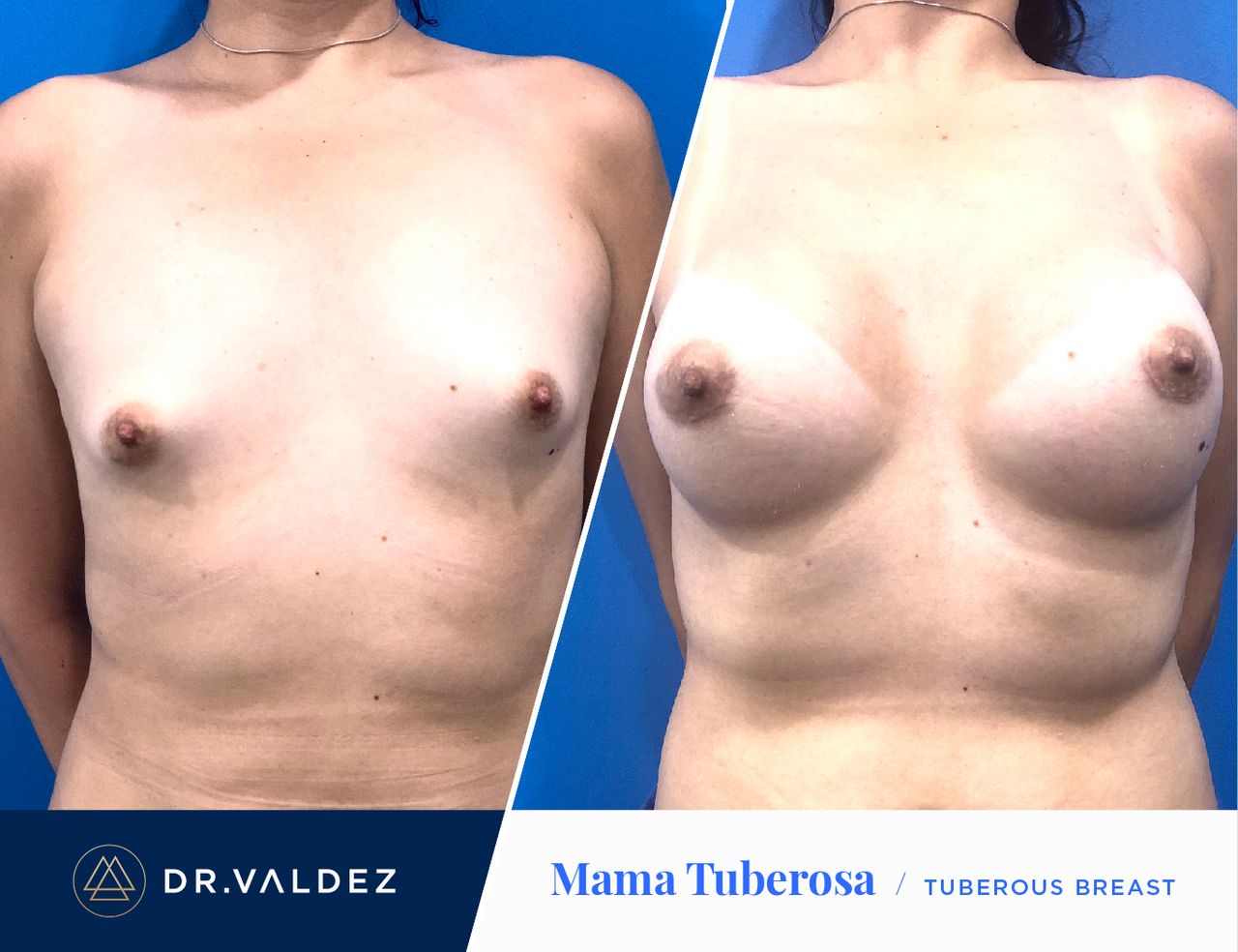 Pedro Arturo Valdez Gomez-24