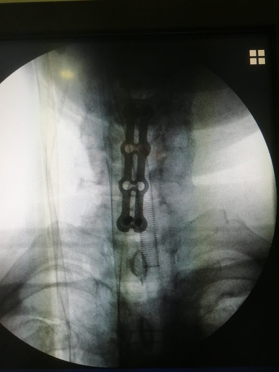 Juan José Luévano De La Cruz-38