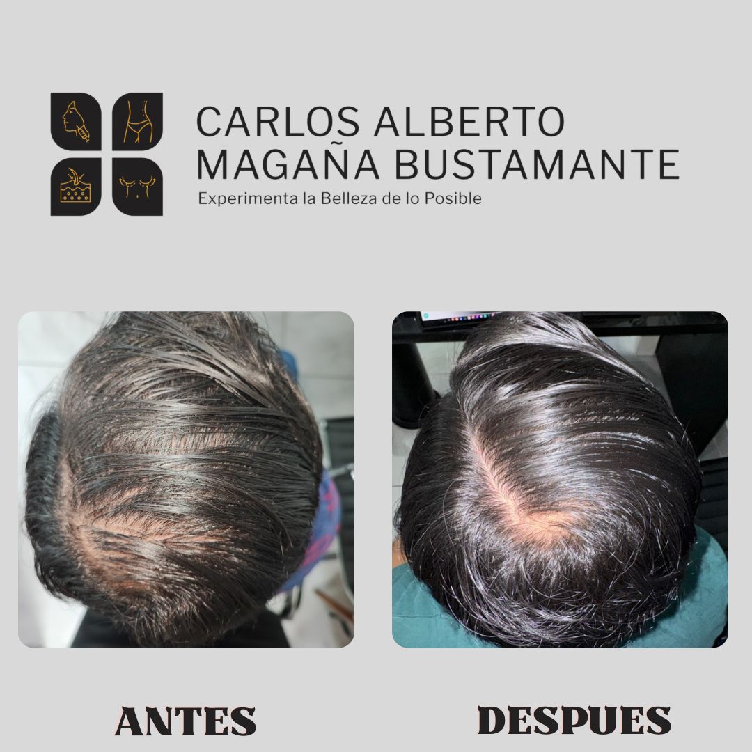 Carlos Alberto Magaña Bustamante-30