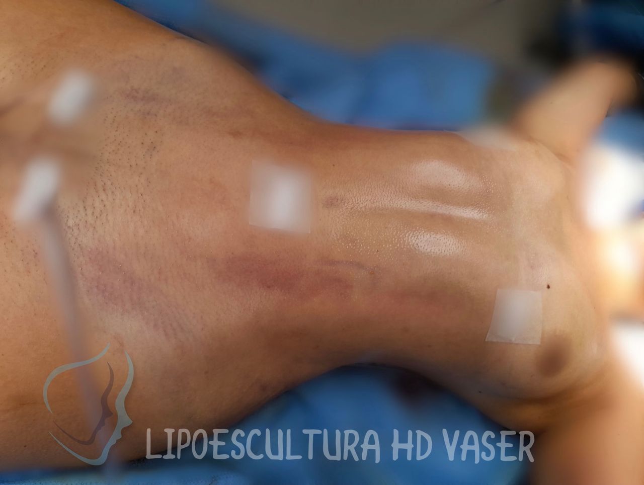 Giuseppe Tanzillo-25