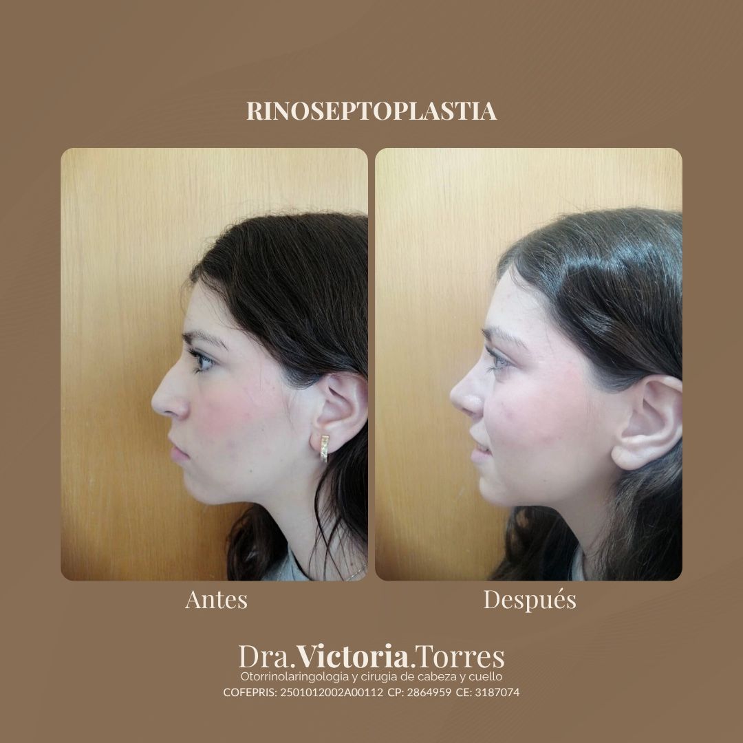 Estela Victoria Torres Galáz-7