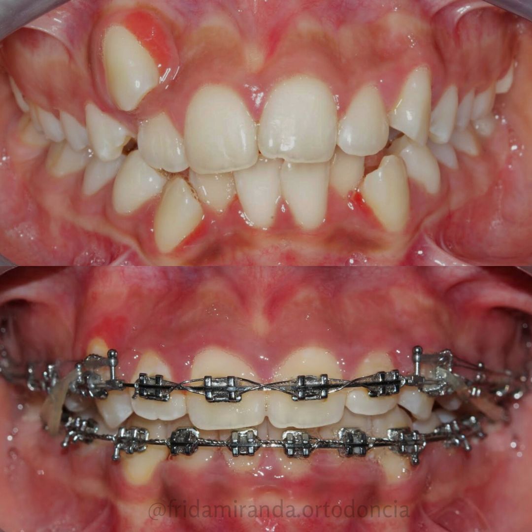 Frida Miranda Alcantar-3