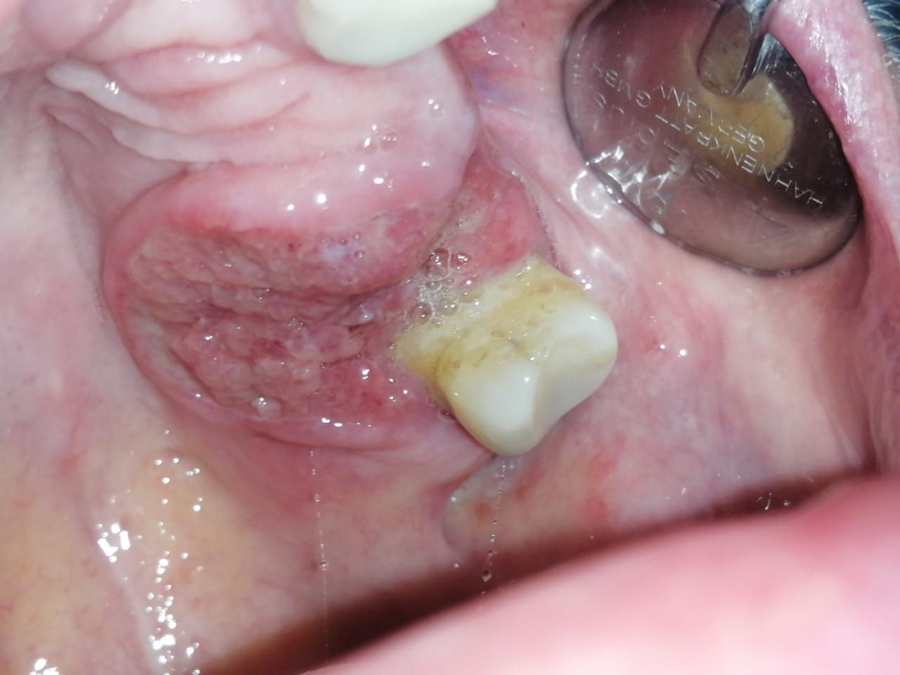 María Teresa Gómez Serrano-5