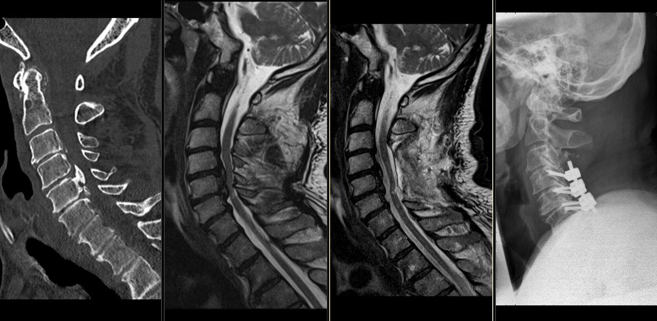 Simón Almanza Mendoza-0