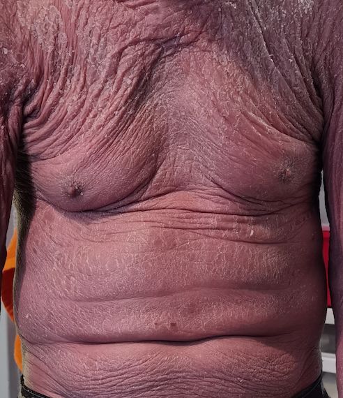 Lauro Francisco Varela Coronado-15