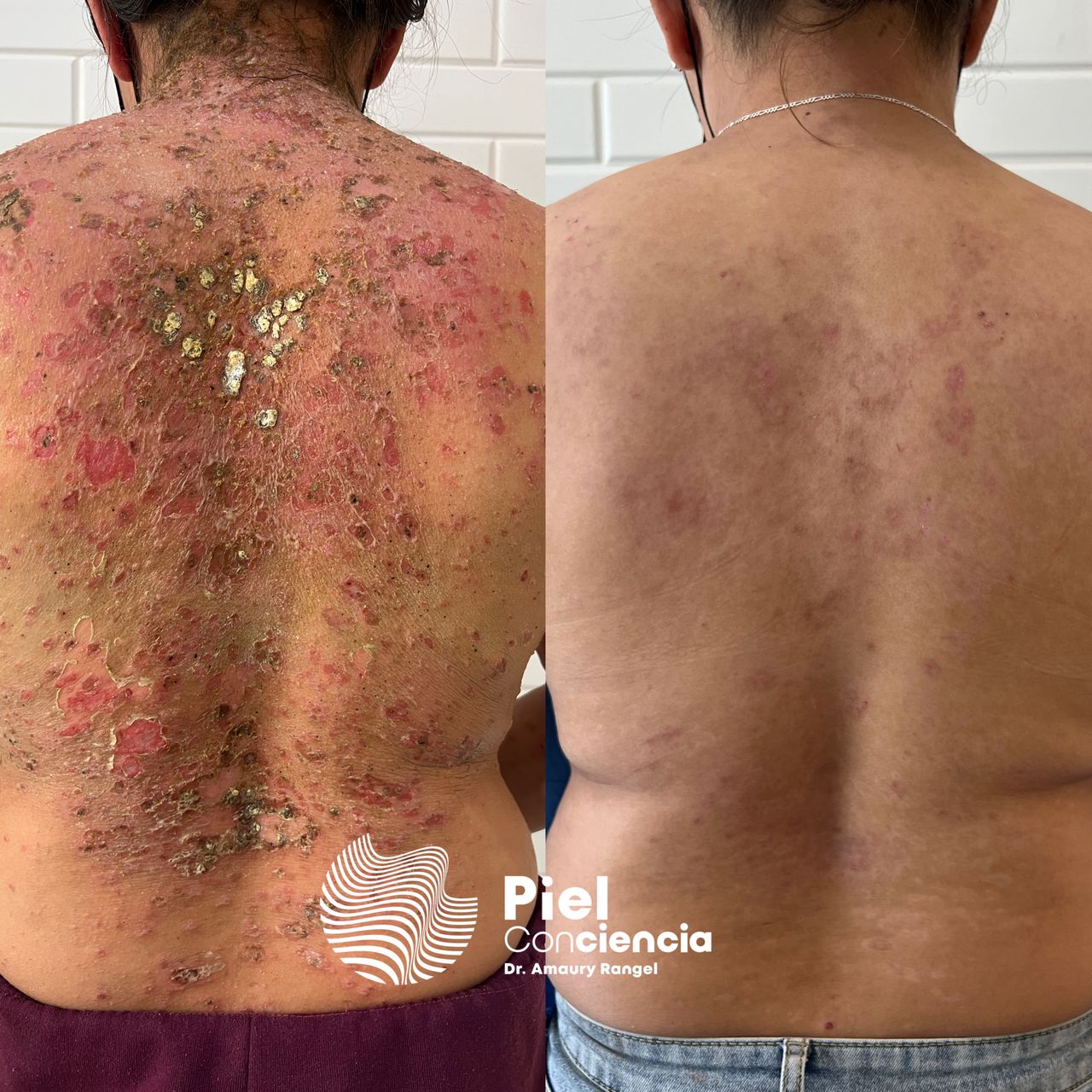 Víctor Amaury Rangel Avilés-35