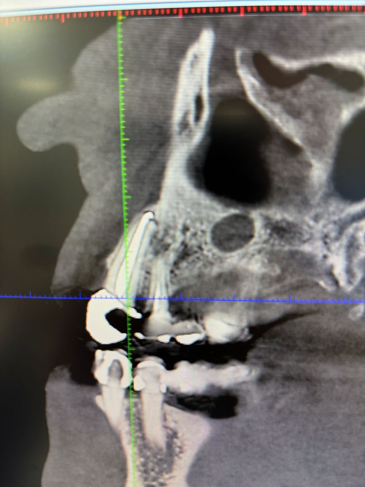 Juan Angel Cruz Rodríguez-9