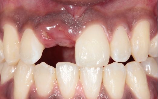 Mariel Itzayani Torres López-15