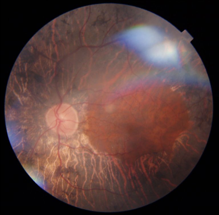 Juan Jose Cueto Gomez-13