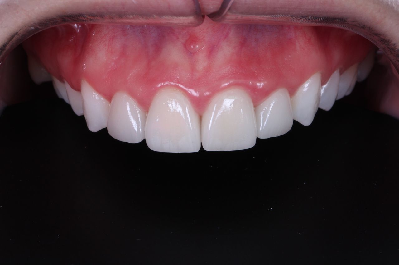 Heidi Mendoza Malagón-6