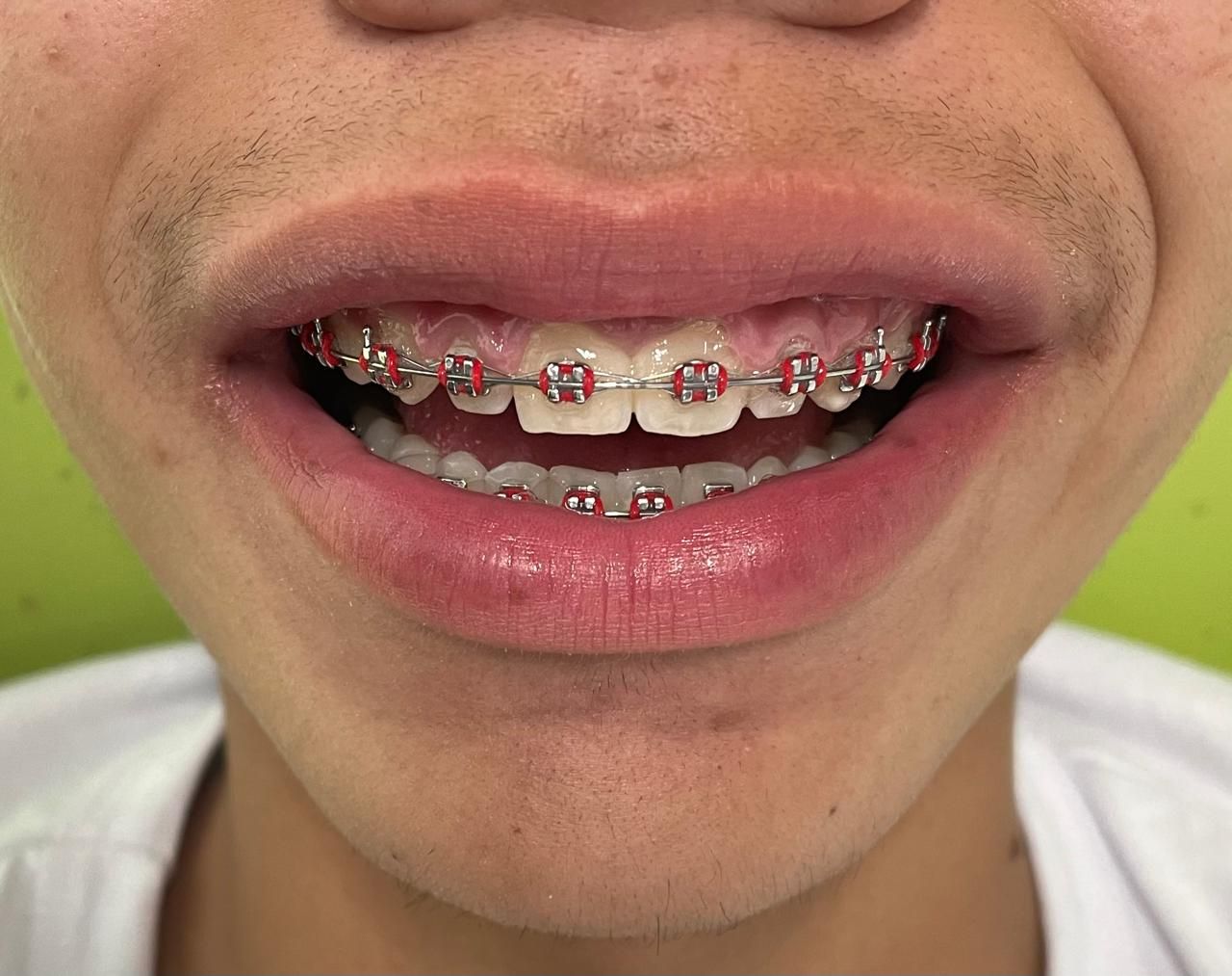 Anuar Becerril Castro-2