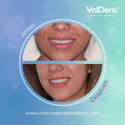 Karla Valdespino Gutierrez-7