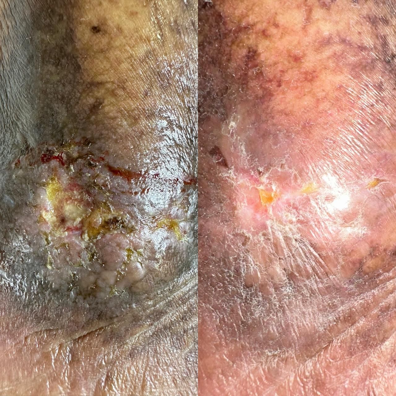 Jhonatan López González-49