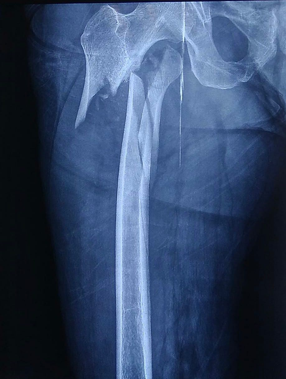 Josmar Adrián Lopez Eng-0