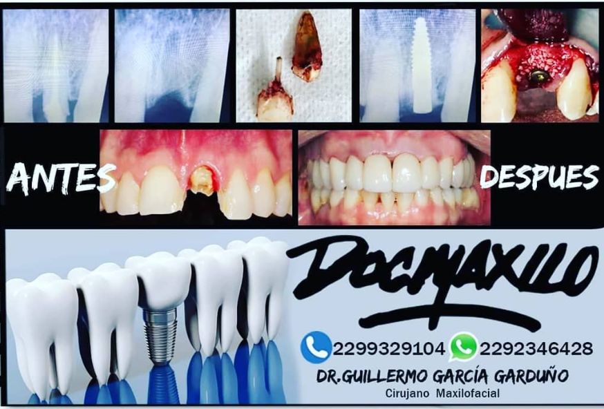 Guillermo García Garduño-9