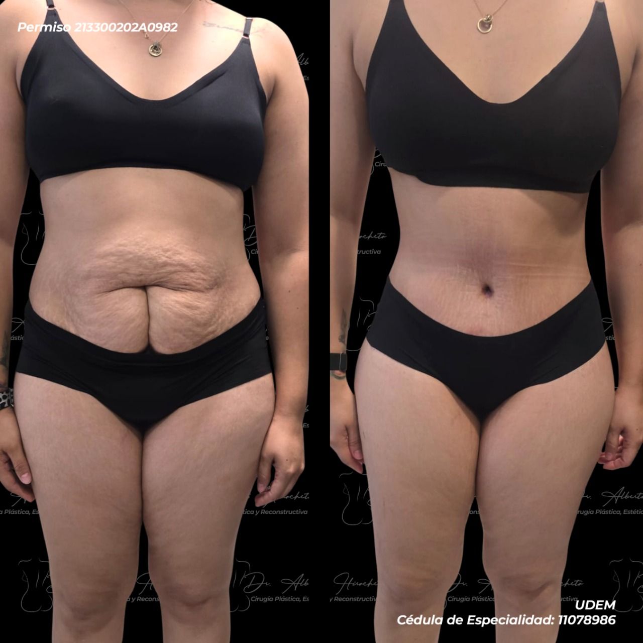 Alberto Hiracheta Torres-29