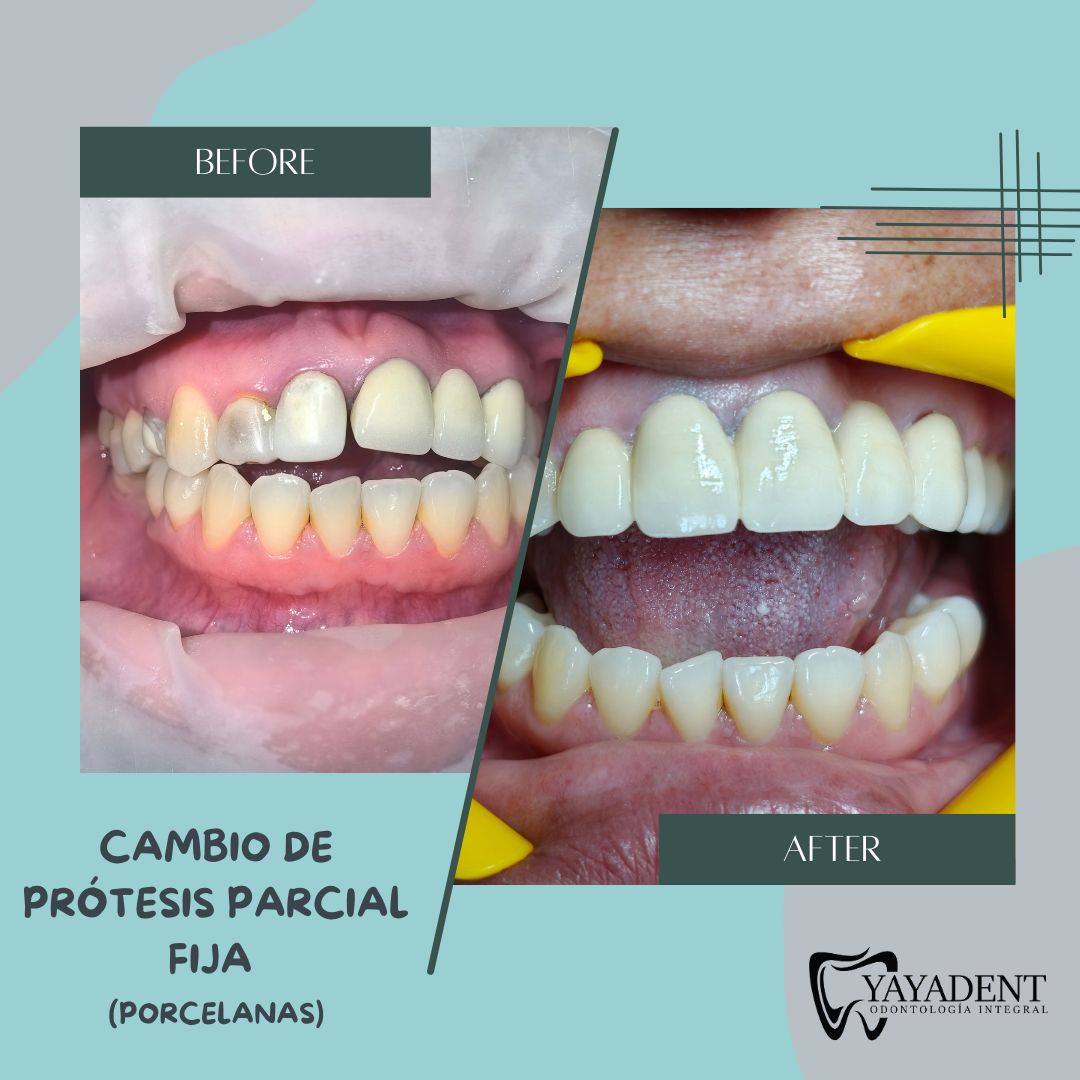 Sibely Yaraset Aranda Rodríguez-1