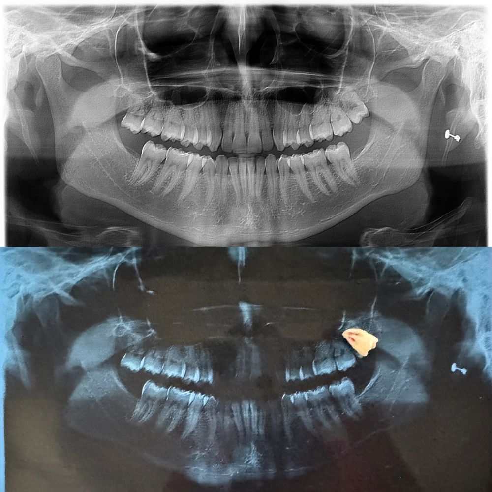 Itzel Abigail Montiel Garces-9