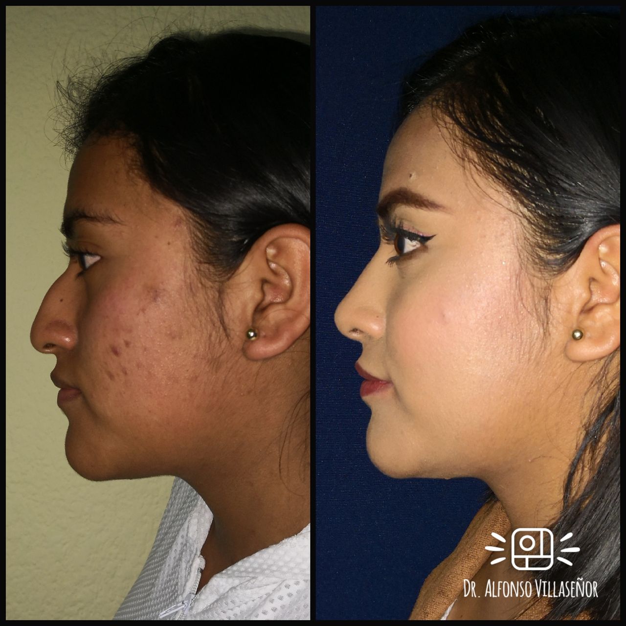 Alfonso Villaseñor Herrero-24