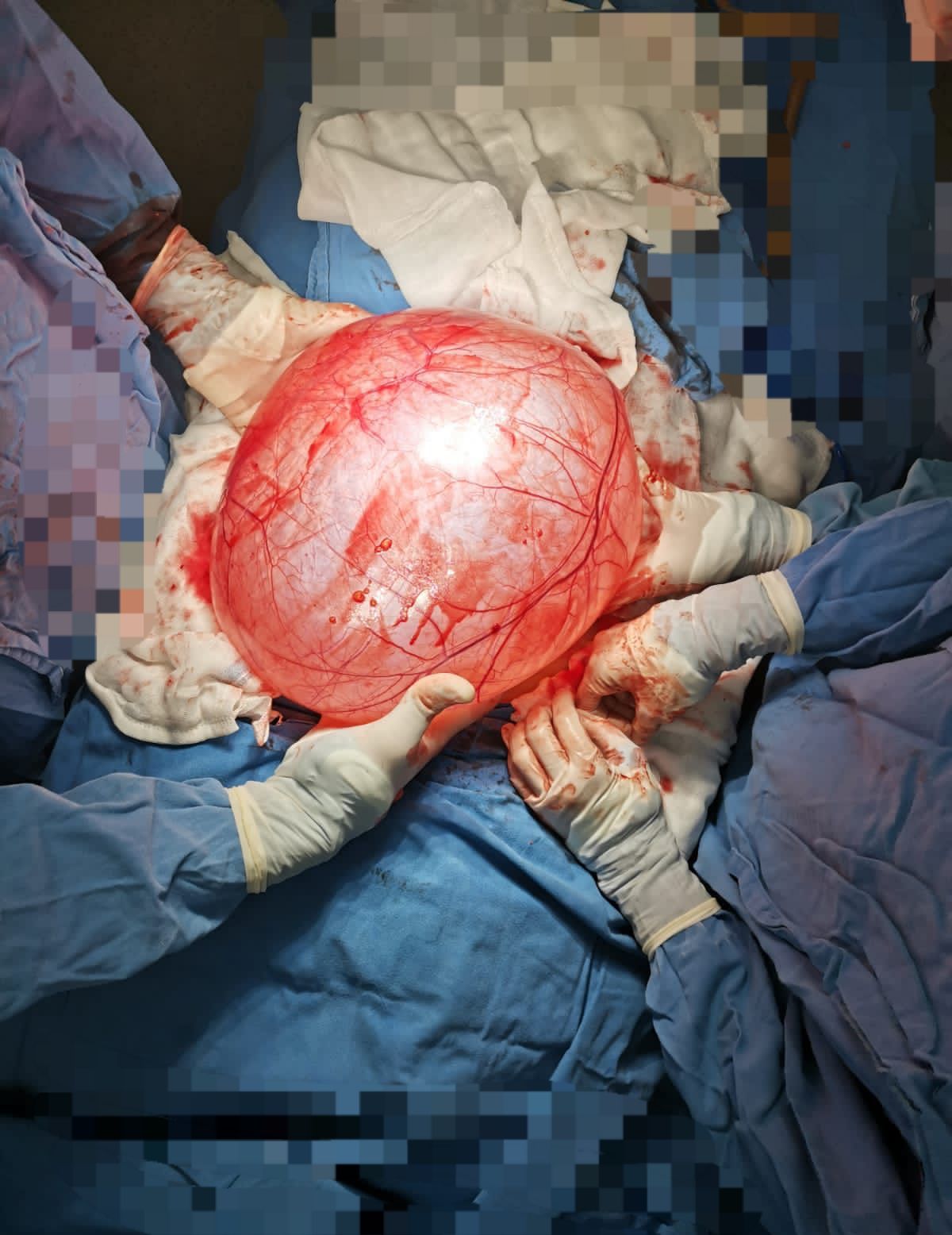 José Miguel Arano Acua-15