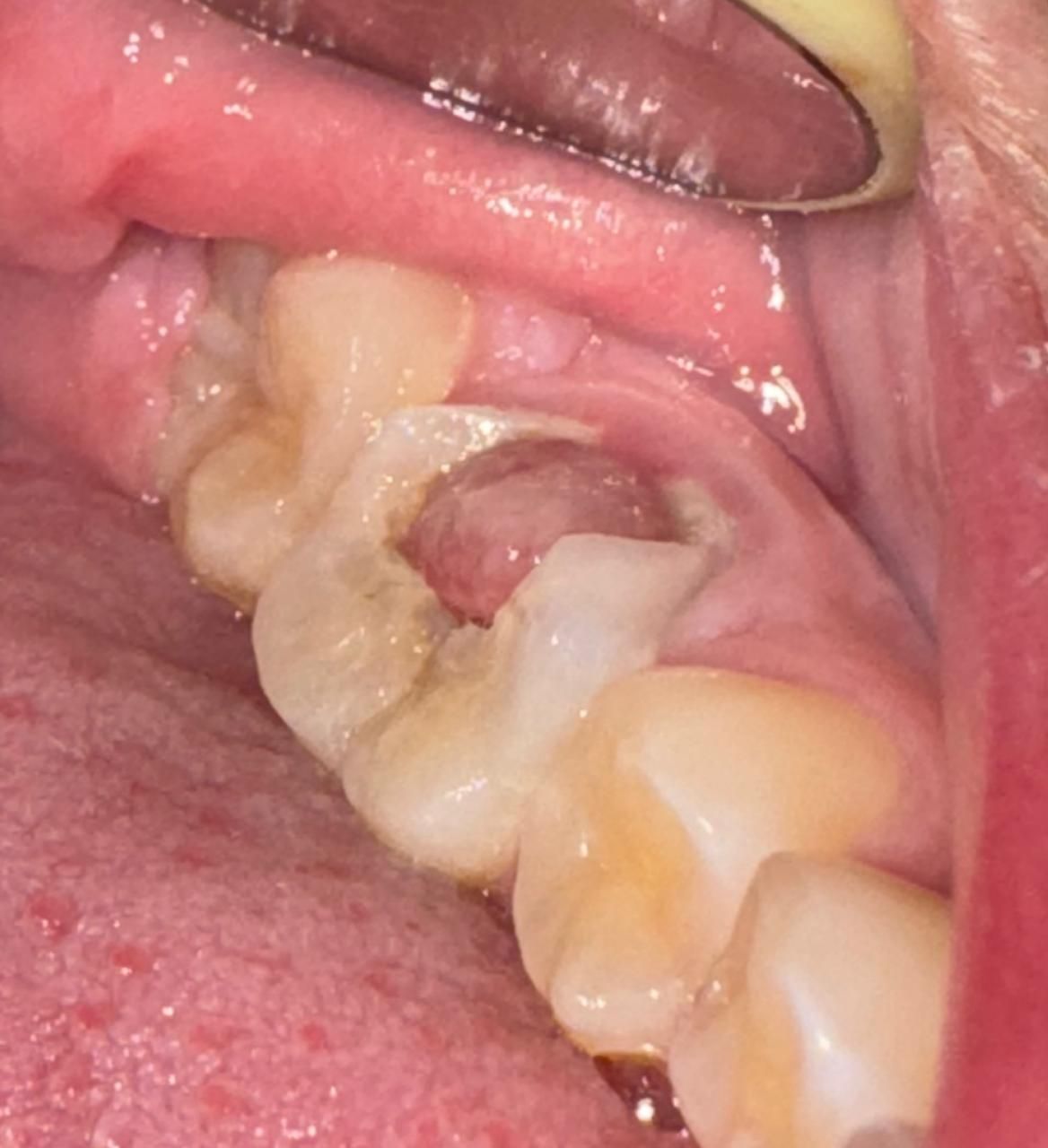 Juan Angel Cruz Rodríguez-18