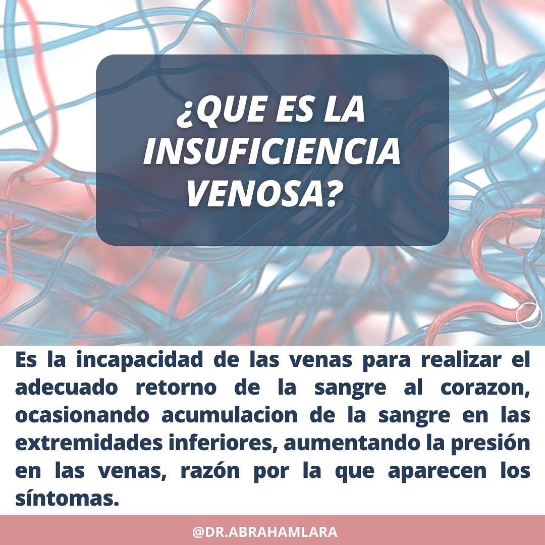 Miguel Abraham Lara Perez-36