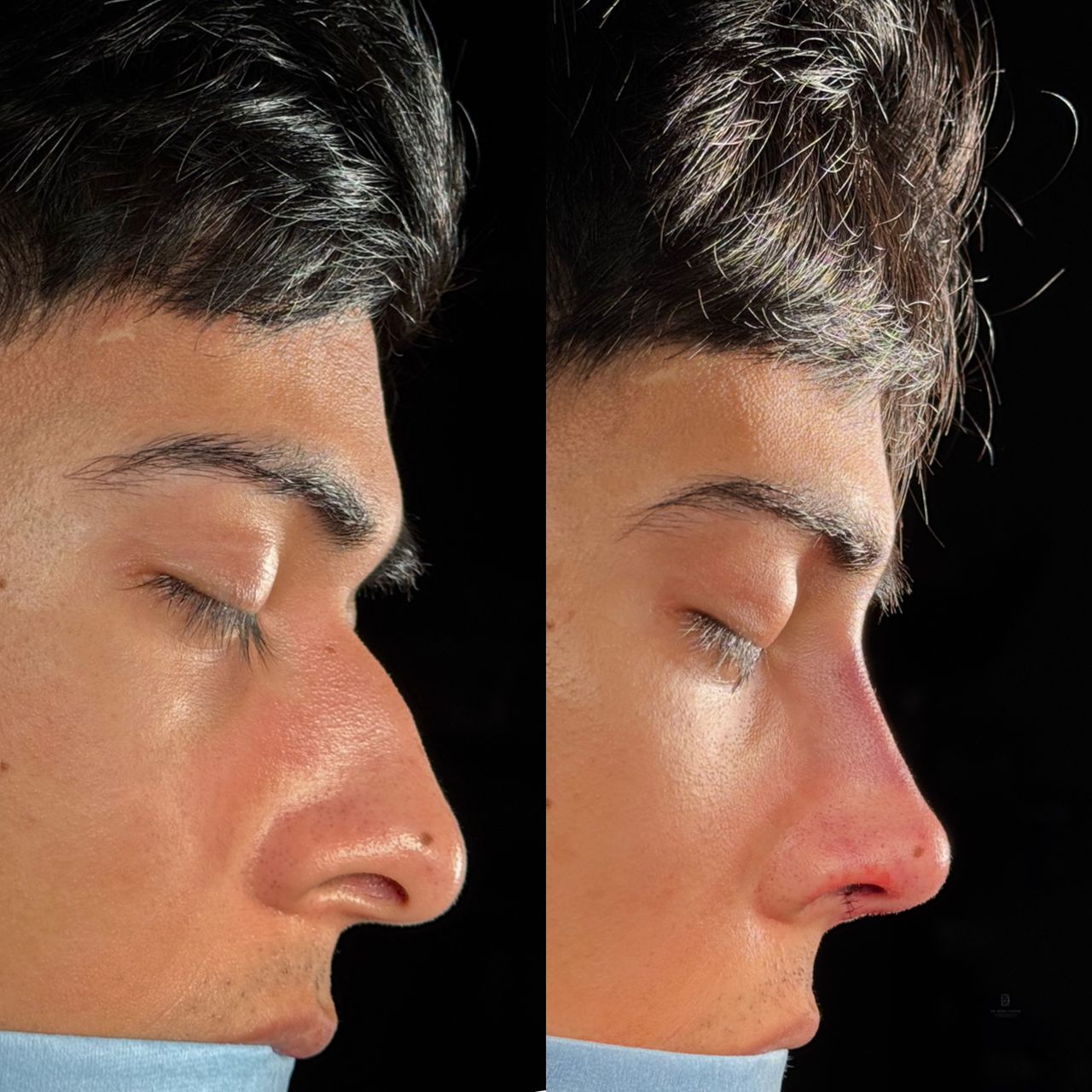 Angel Castro Urquizo-221