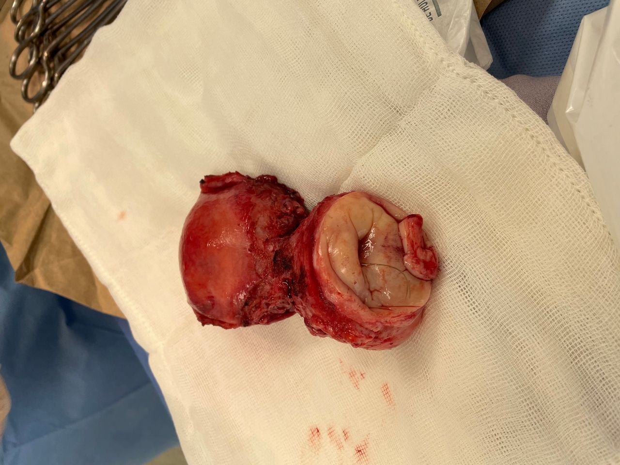 Gonzalo Hernández Martínez-37