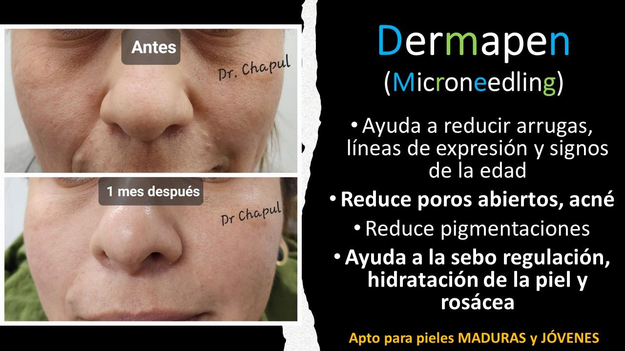 José Luis Muñoz Chapul-9