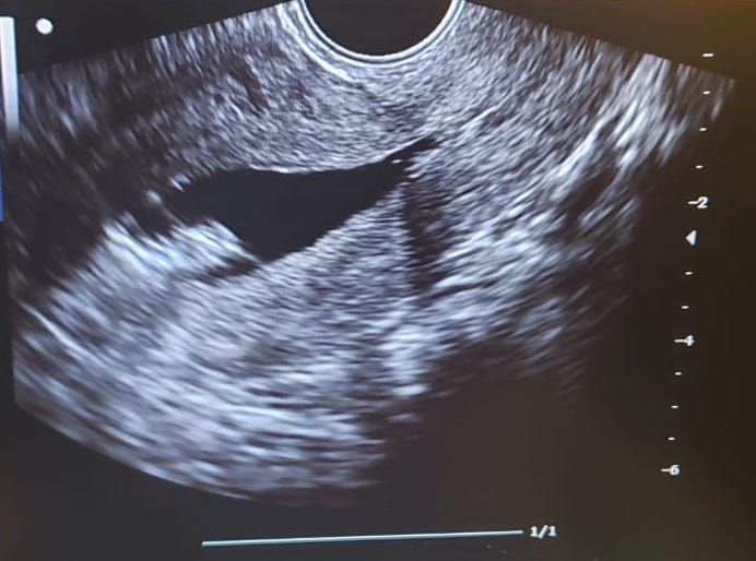 Germán Gabriel Palacios López-9