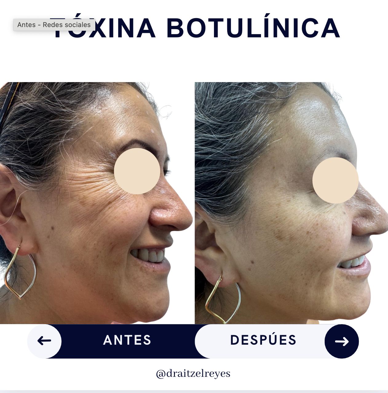 Itzel Anayn Flores Reyes-26