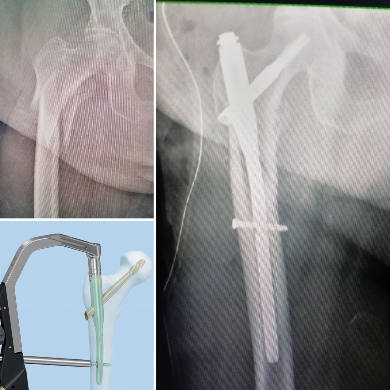 Alfredo Sandoval Plata-23