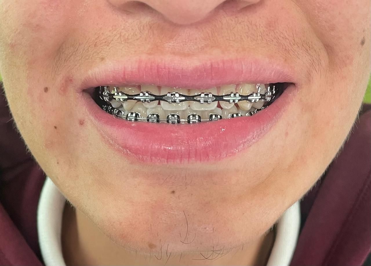 Anuar Becerril Castro-14