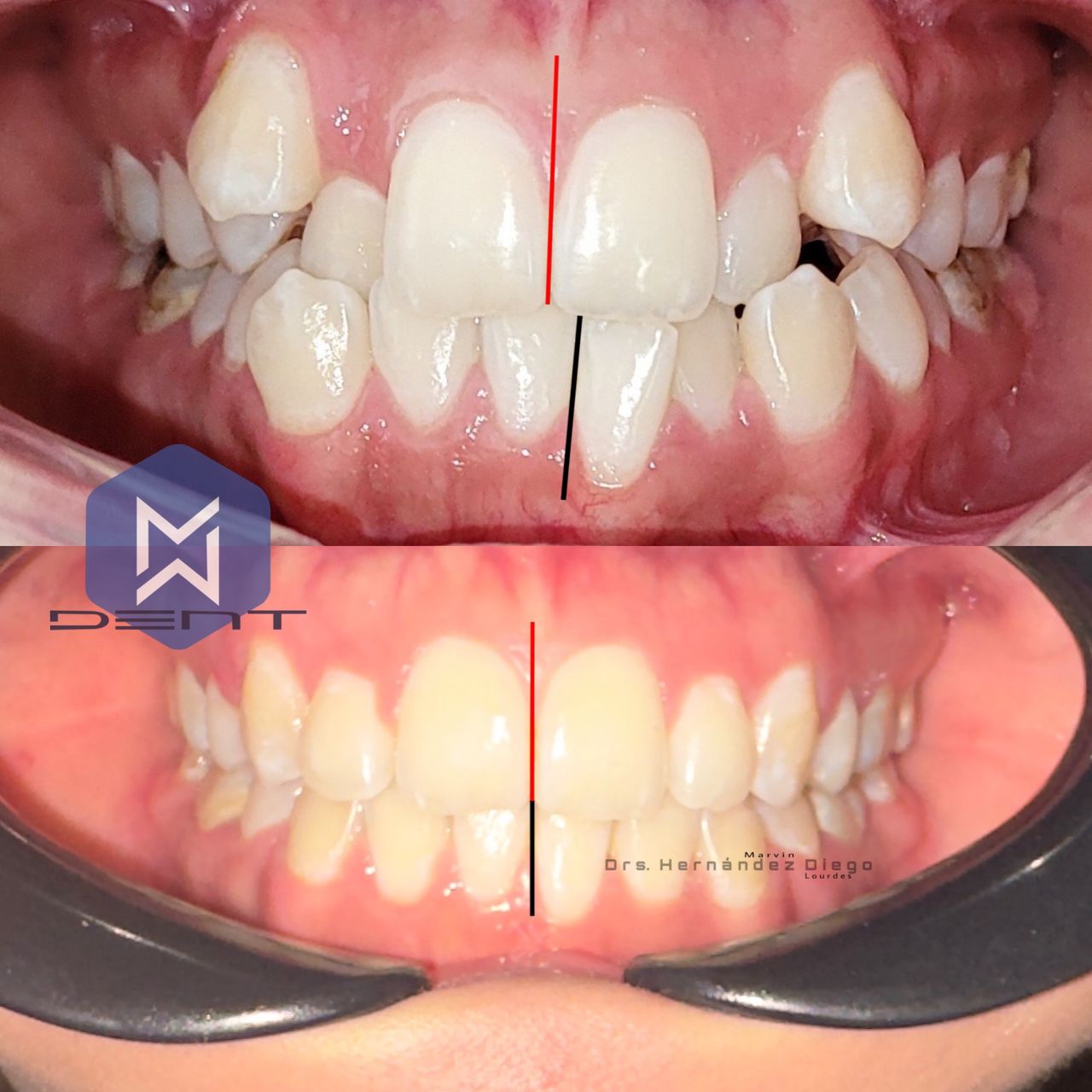 Marvin Adair Hernández Álvarez-20