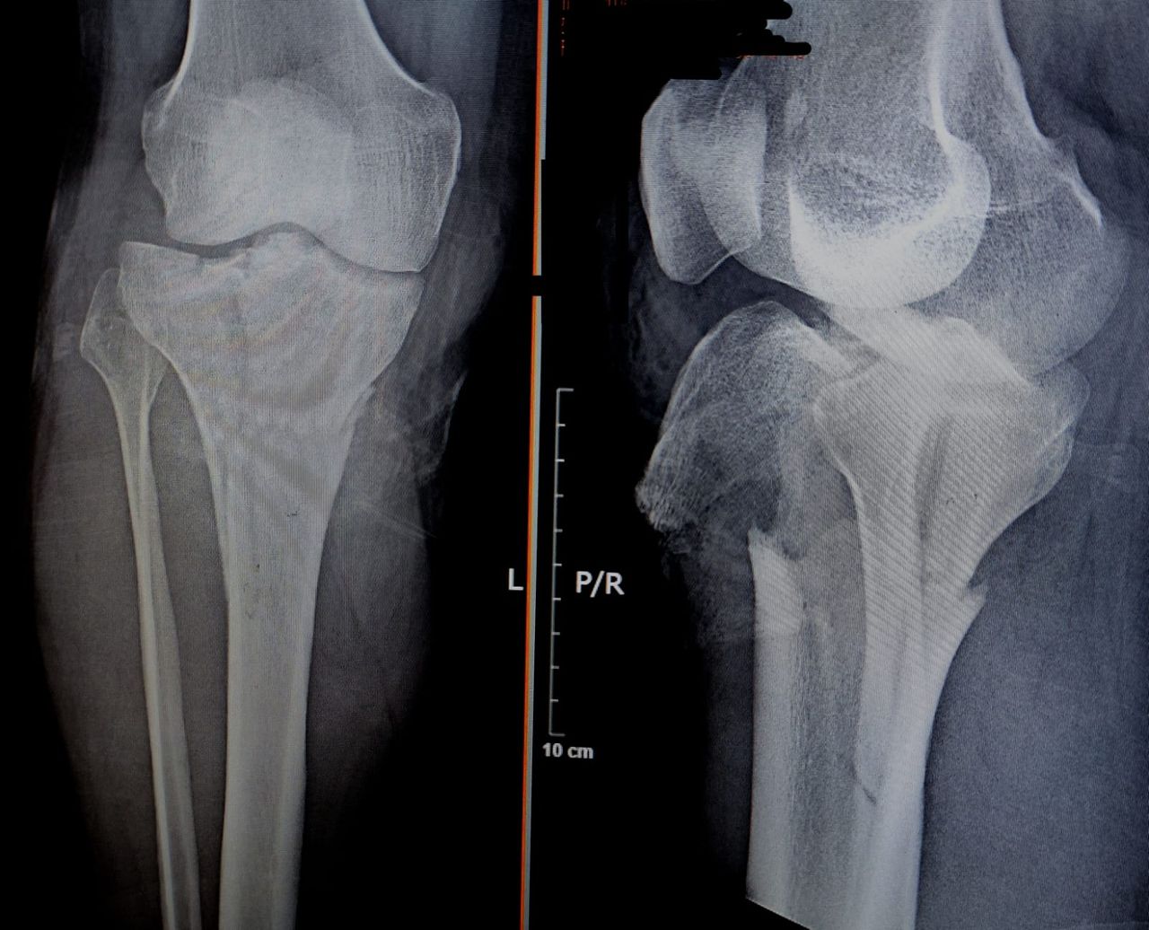 Luis Angel Moreno Espinoza-10