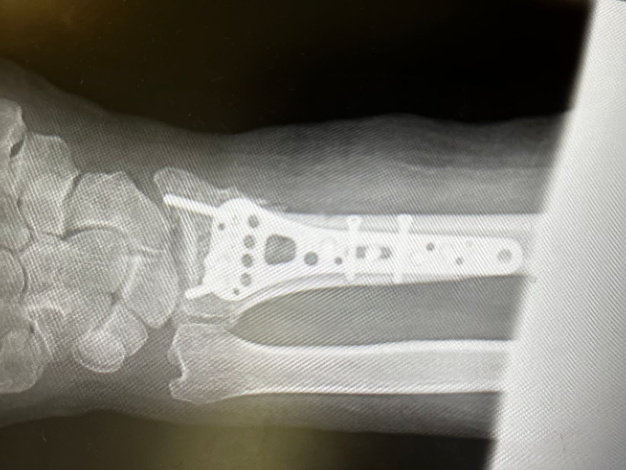 Alberto Lorenzo Cortés-4