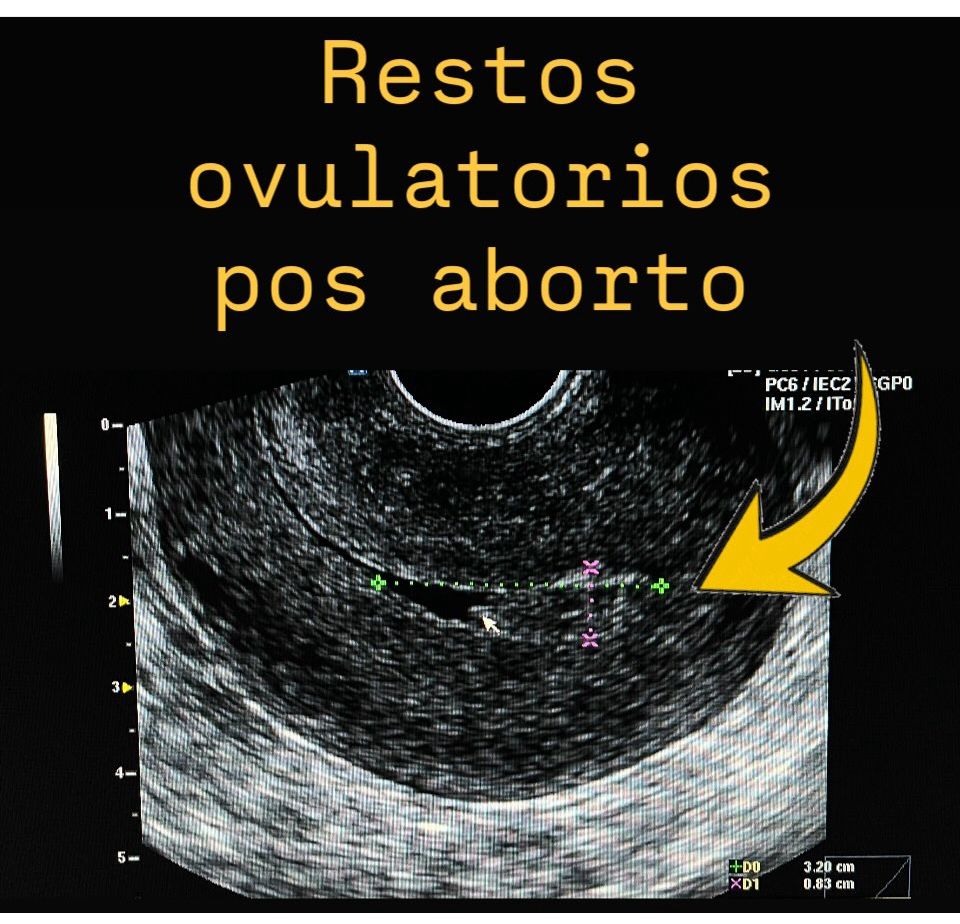 Ana Itzel Gaona Guevara-9