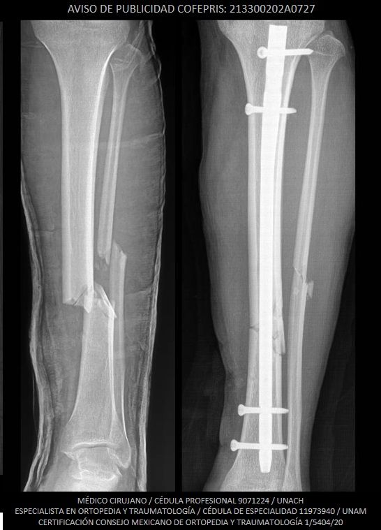 Luis Castañón Robles-10