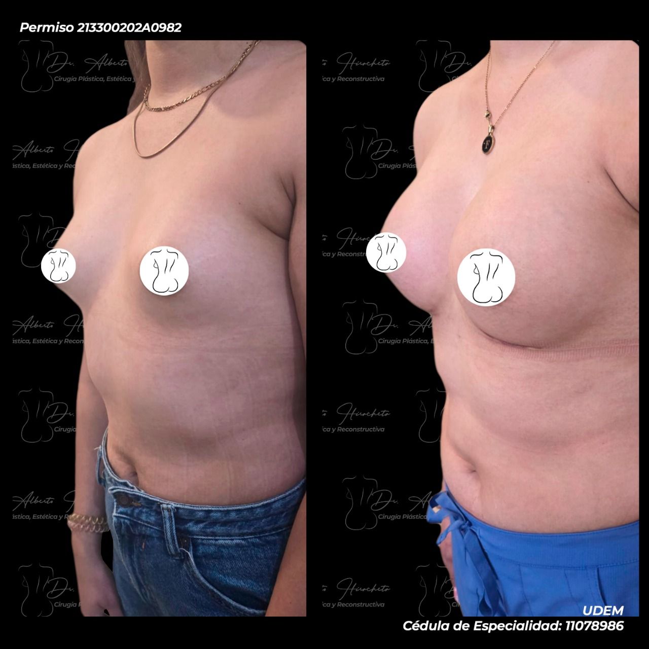 Alberto Hiracheta Torres-26