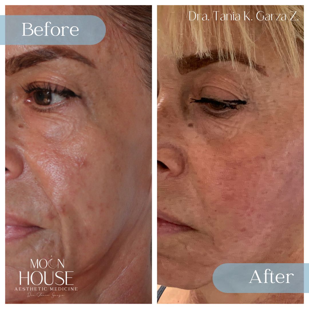 Tania Karine Garza Zepeda-26