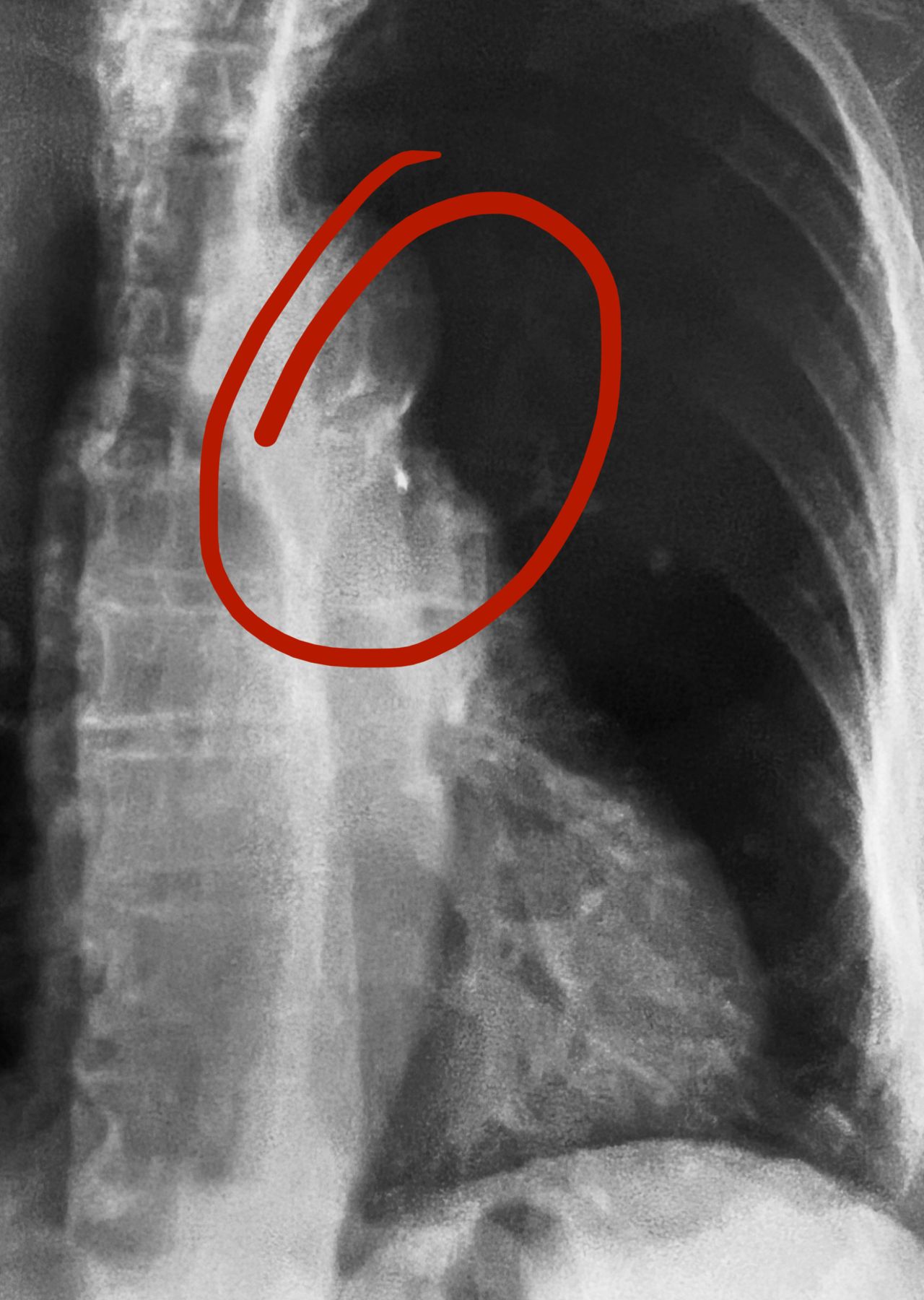 Abdón Ávila Chávez-19