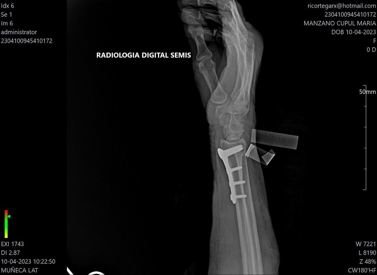 Carlos Humberto Vera Torres-7