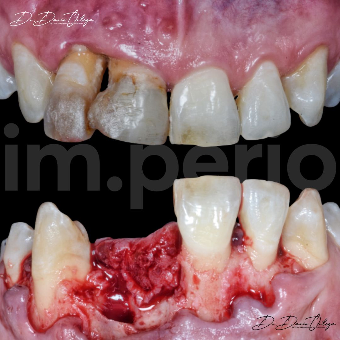 Dario Ortega Aceves-25