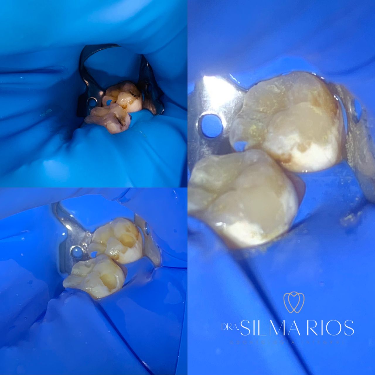 Silma Chavez Rios-14