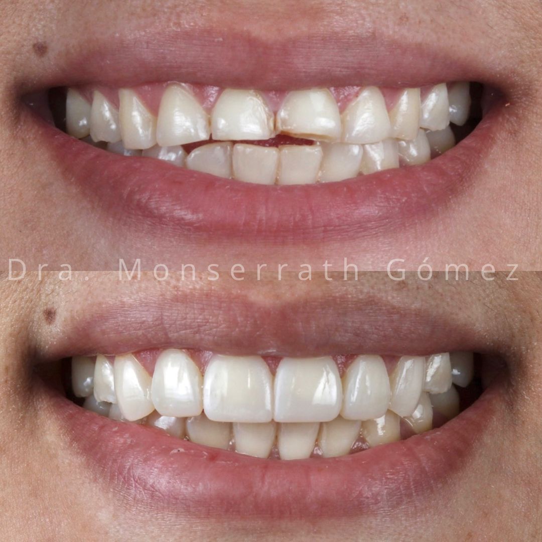 Monserrath Gomez Mendez-6