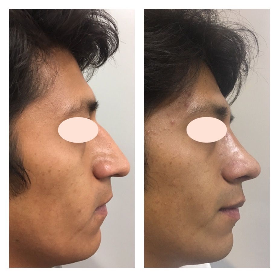 Carola Berenice Curiel Davalos-41