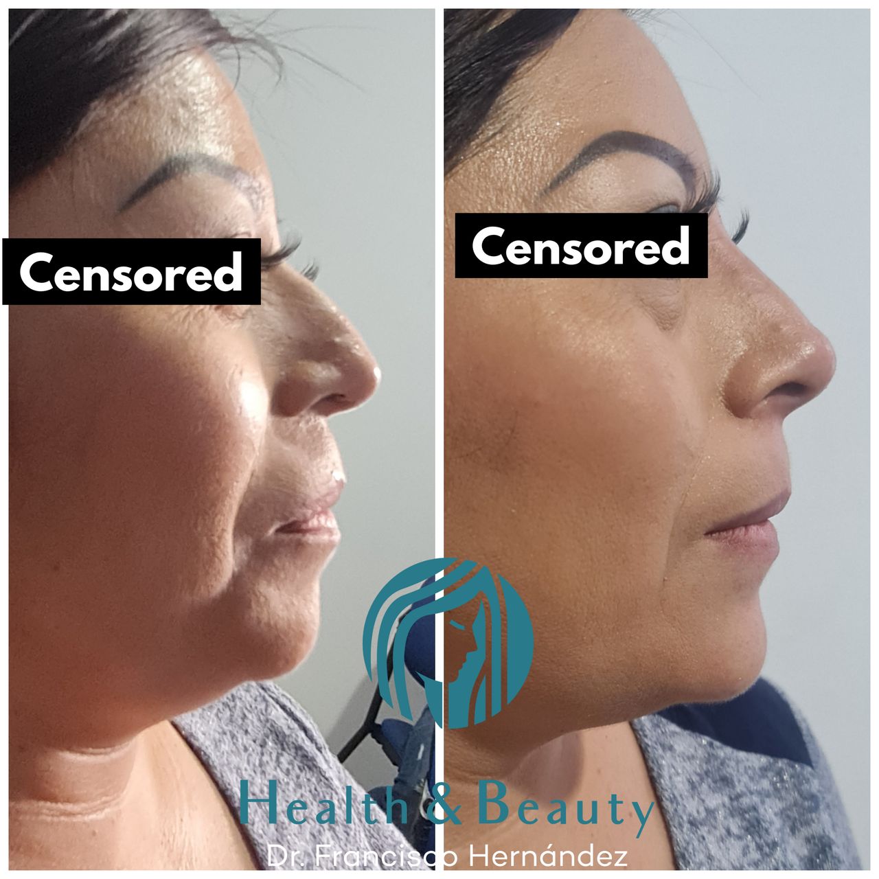 Francisco Hernández Gómez Crespo-80